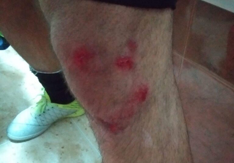 Compromís denuncia que el mal estat del parquet del poliesportiu Sebastián Mora causa danys als esportistes